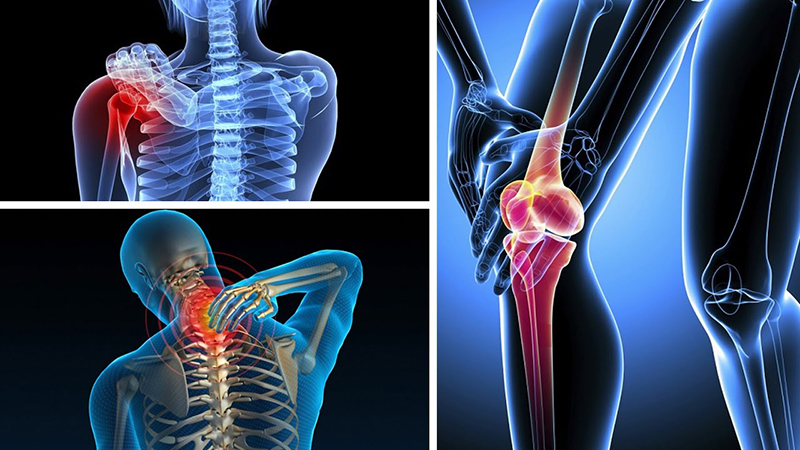 Những căn bệnh xương khớp phổ biến tại Việt Nam, bạn cần biết